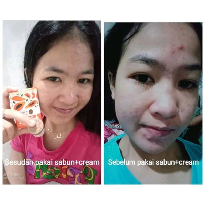 SABUN SP SUPER THAI DAN DOSTING SUPER THAI