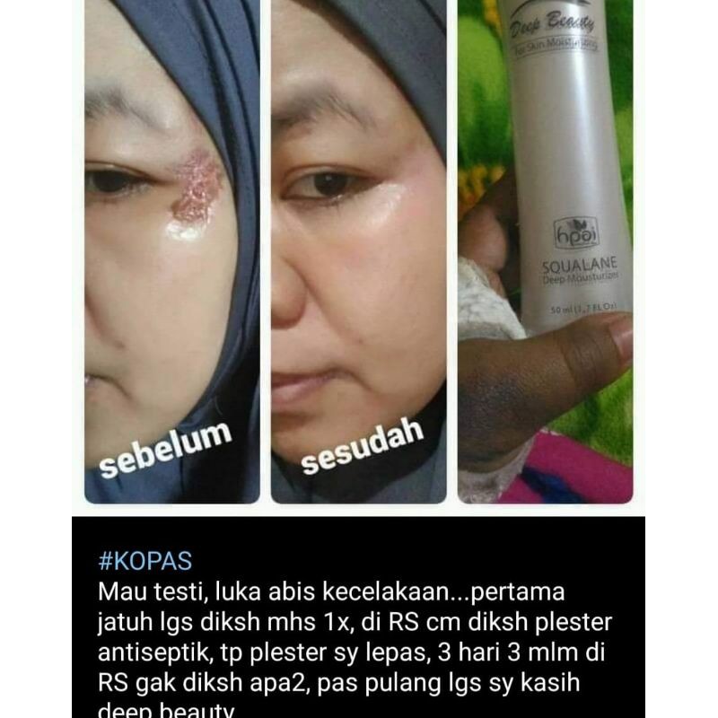 

Deep Beauty HNI HPAI Cerah alami