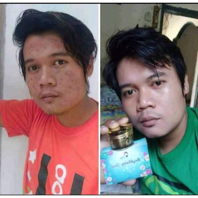 PROMO‼️Gold Jelly 2 + Free Sabun Kedas Beauty  100% ORI BPOM Siang Malam Pemutih Wajah-7