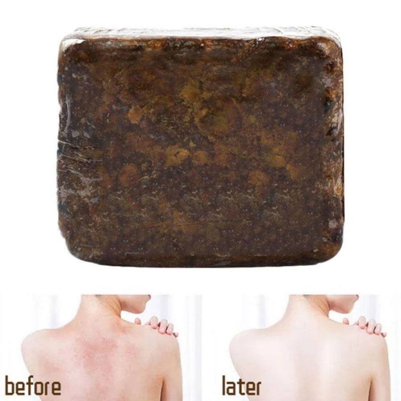 african black soap / imported from USA. SABUN JERAWAT ACNE, SABUN EKSIM PSORIASIS