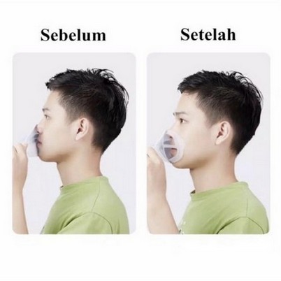 OS Penyangga MAsker 3D Mask Bracket SIlikon SIrkulasi Udara