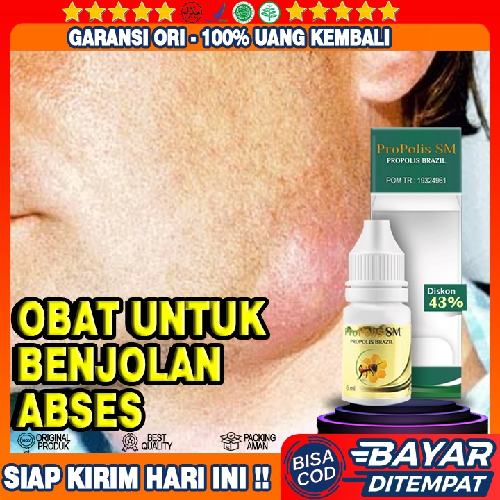 Obat Salep Herbal Benjolan Abses, Fistula Ani, Fisura, Fistula Anal, Ambeien, Wasir