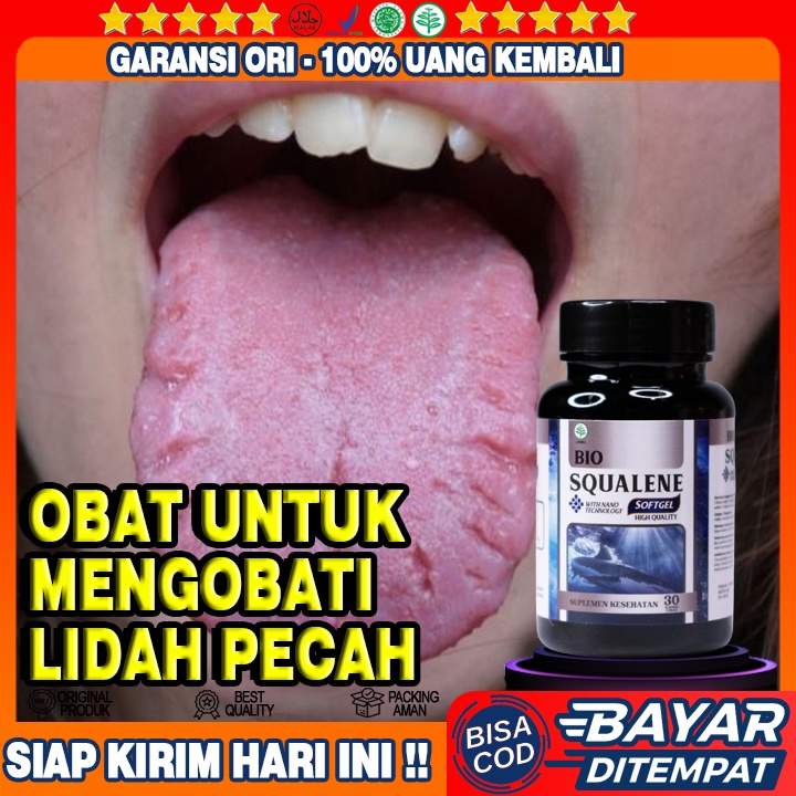 Obat Lidah Pecah Pecah - Obat Lidah Luka - Obat Lidah Putih - Obat Lidah Mati Rasa - Obat Sariawan -