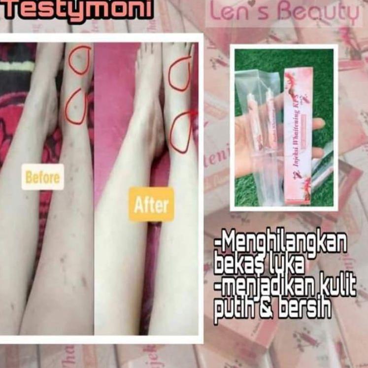 Suntik Pemutih Badan Whitening KFS Memutihkan Badan Tanpa Suntik Asli 100% 0M4