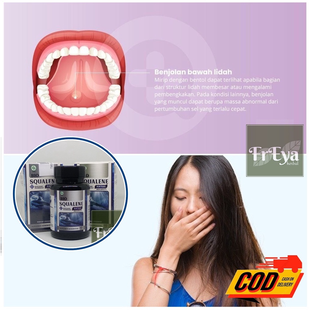 OBAT BENJOLAN DI BAWAH LIDAH, OBAT BENJOLAN DI LIDAH (BISA COD)
