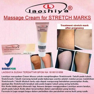 Ampuh Cream Krim Penghilang Stretch Mark Stretchmark Alami Aman Ibu Hamil Salep Gly Derm Apotik Shopee Indonesia