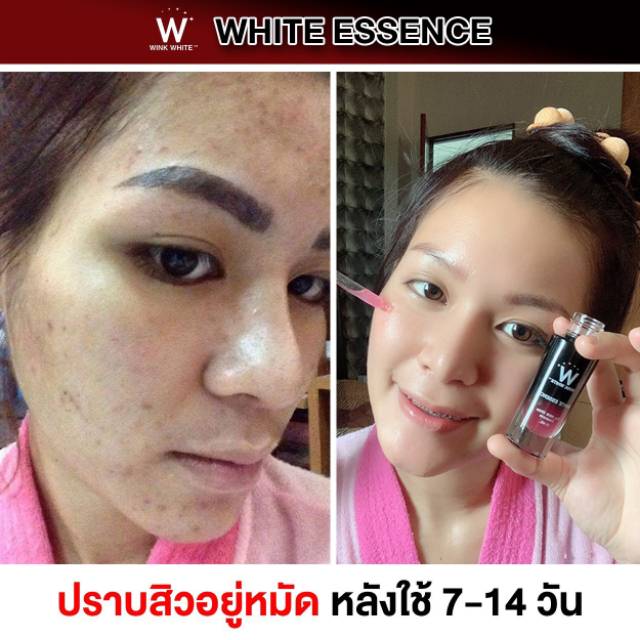 Winkwhite Wink White Essence Free Black Hyaluronic Mask Shopee Indonesia