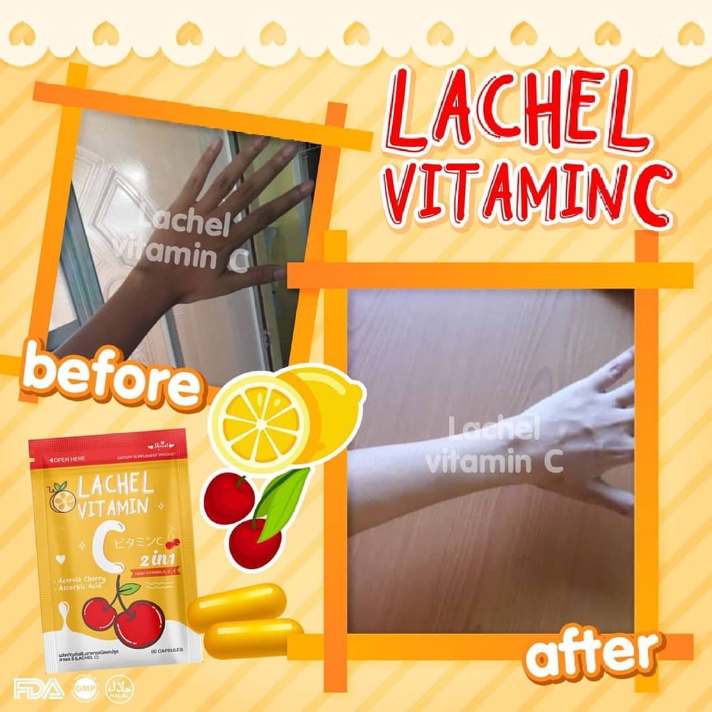 LACHEL VITAMIN C ISI 60 KAPSUL by Skinest Clinic