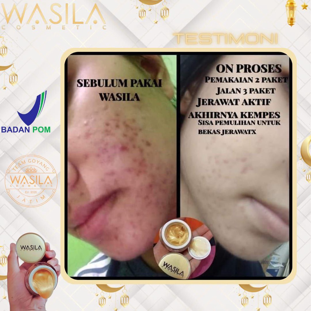 GOLD GELL WASILA COSMETIC/WA BEAUTY/PREMIUM GLOWING(KEMASAN BARU)