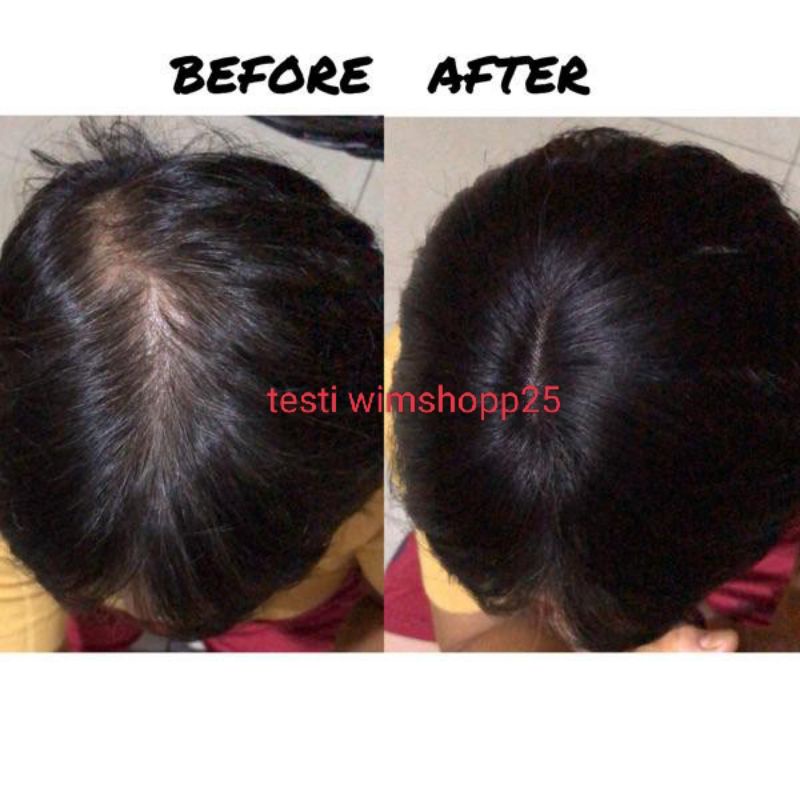 MINYAK KEMIRI PENUMBUH RAMBUT/MENGURANGI RAMBUT RONTOK