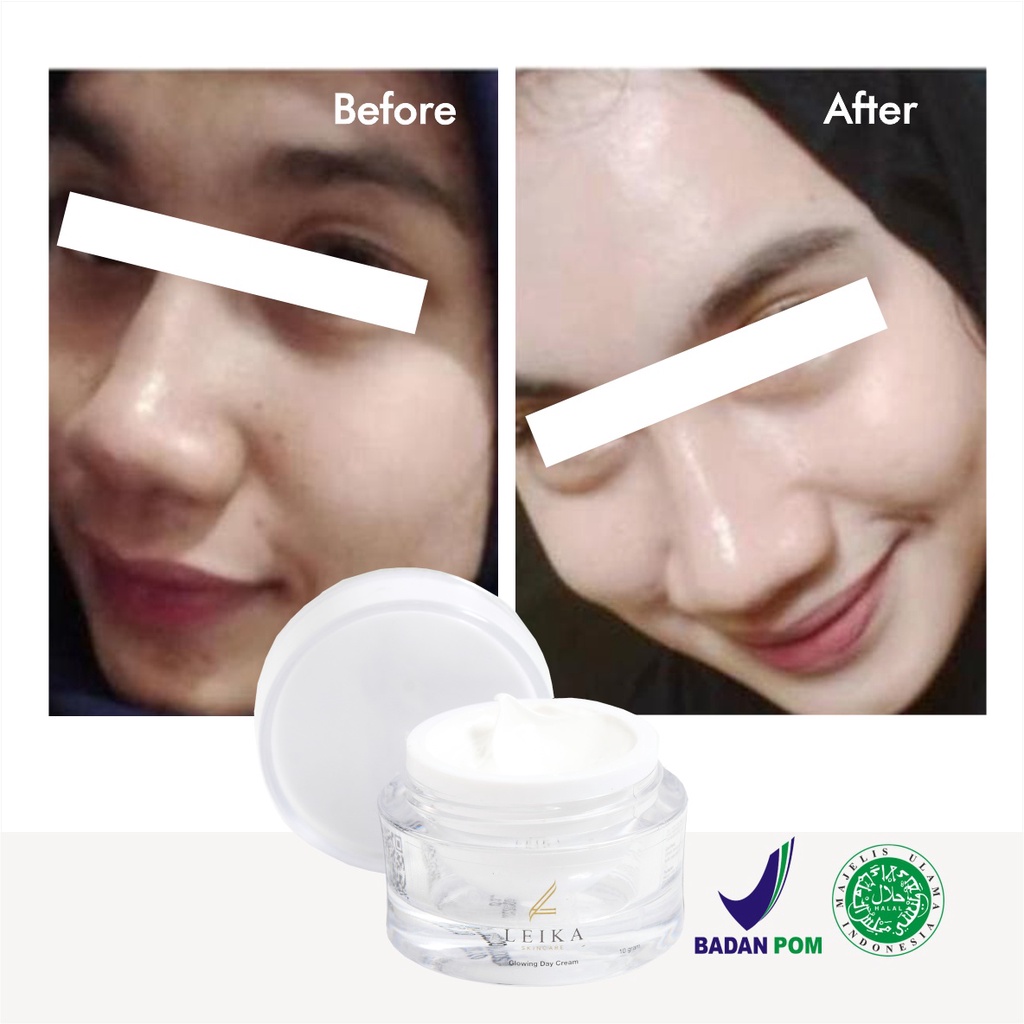 Glowing Putih Cepat! Krim untuk Kulit Wajah Glowing Putih Cepat Original BPOM Halal Murah Ampuh Cream Wajah Glowing Korea Asli Permanen Glowing Day Cream Leika Skincare 10gr Resmi BPOM