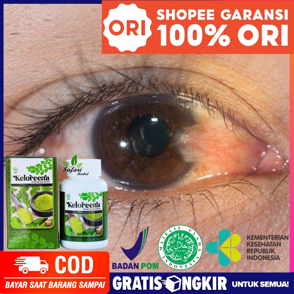 Obat Penghilang Lemak Mata, Lemak Di Mata Hilang, Obat Mata Berlemak - Keloreena Kapsul Daun Kelor