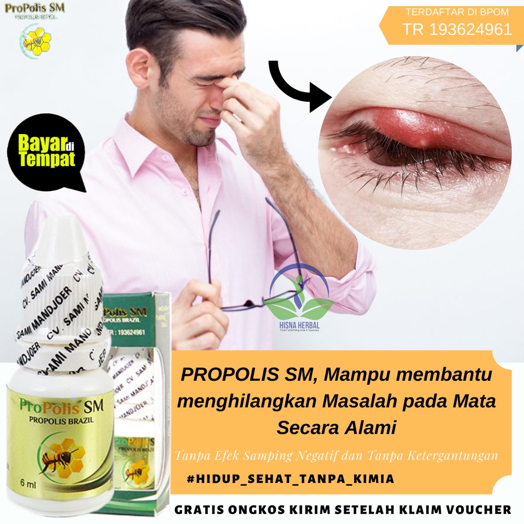 Obat Untuk Radang Kelopak Mata
