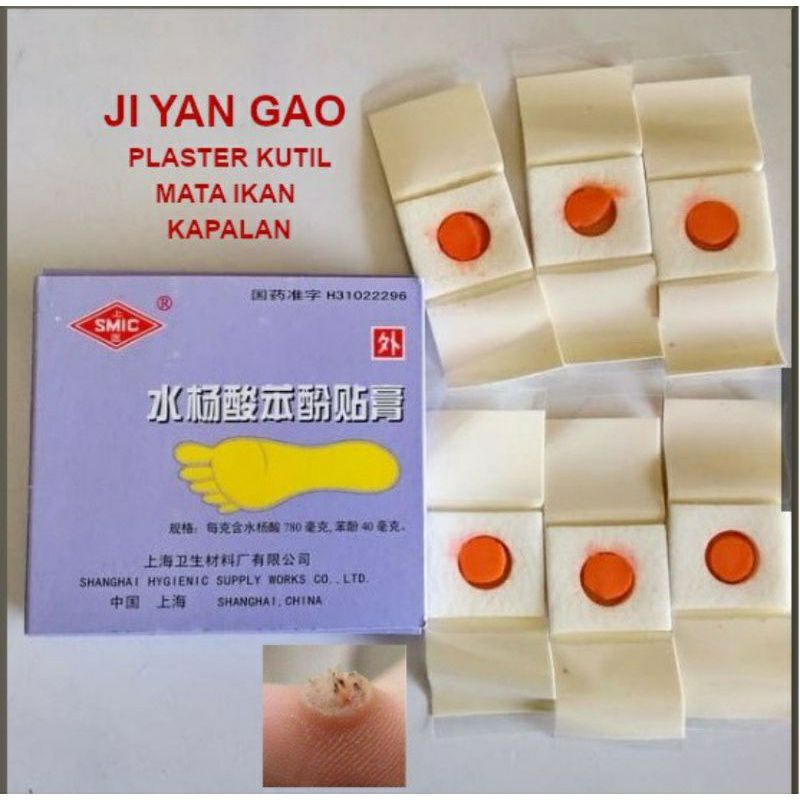 Plester Kutil Mata Ikan Kaki Kapalan Ji Yan Gao Obat Kutil Mata Ikan Kaki Kapalan [1 Box Isi 6Pcs]