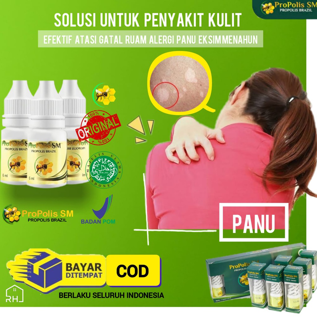 Obat Eksim/ Obat Oles Eksim Kering Menahun/ Penghilang Gatel/ Gatal/ Gatal2 Eksim Basah di Kaki - He