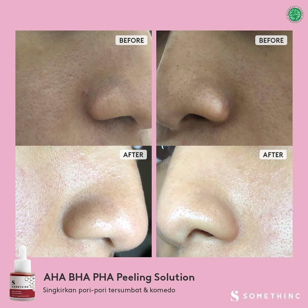 SOMETHINC AHA BHA PHA Peeling Solution 20ml / Peeling somethinc