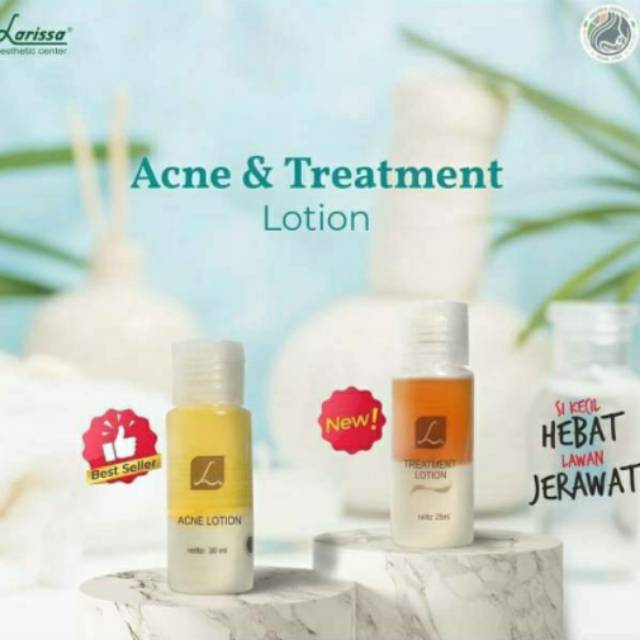 acne treatment lotion larissa