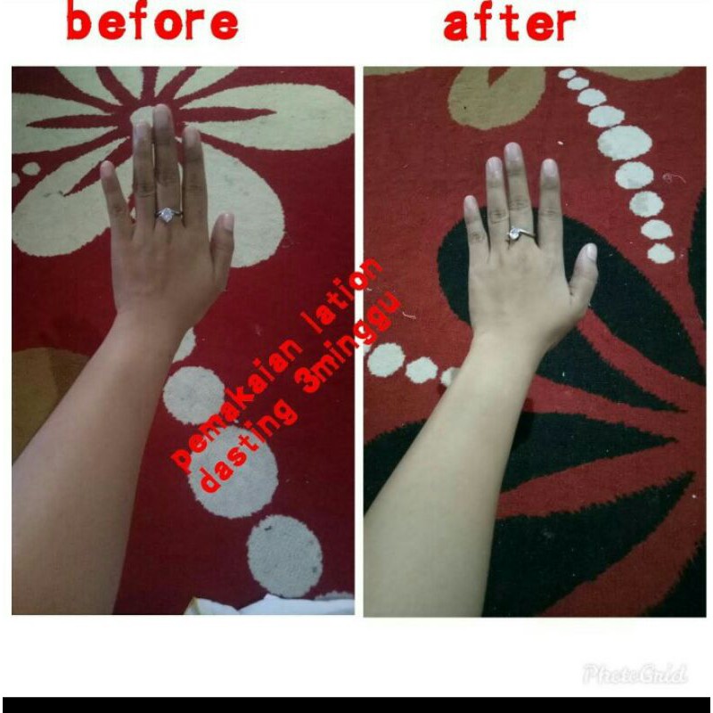 hb dostimg racikan farmasi  tripel dosis