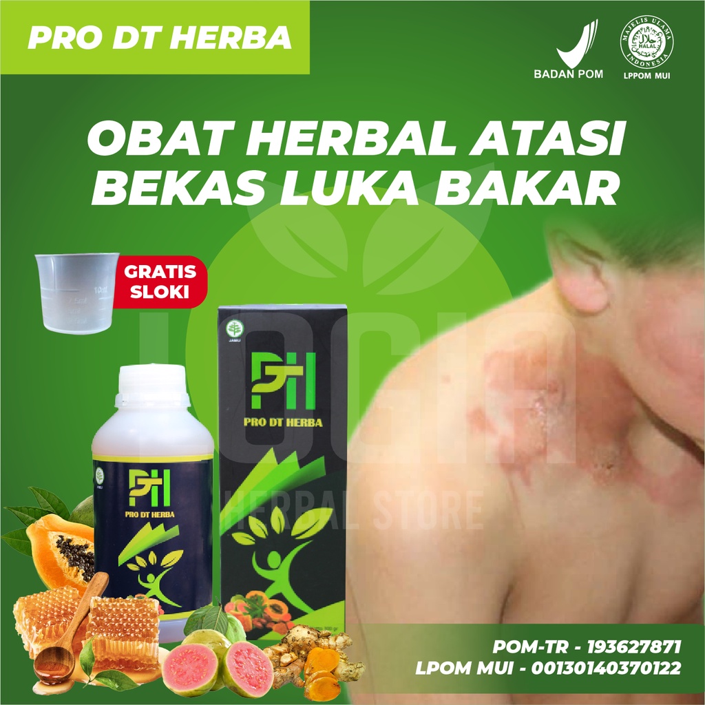 Obat Luka Bakar Paling Ampuh Tanpa Efek Samping, Obat luka bakar di kulit ampuh 100% dijamin langsun