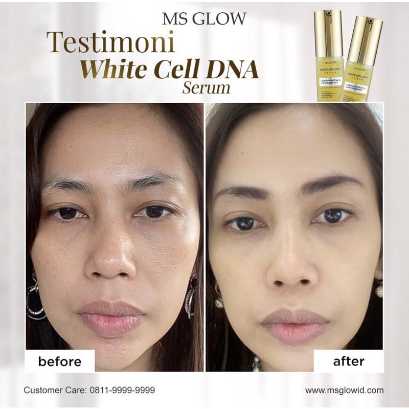 MS GLOW White Cell DNA Night Cream | Serum Msglow White Cell DNA | Toner Essence