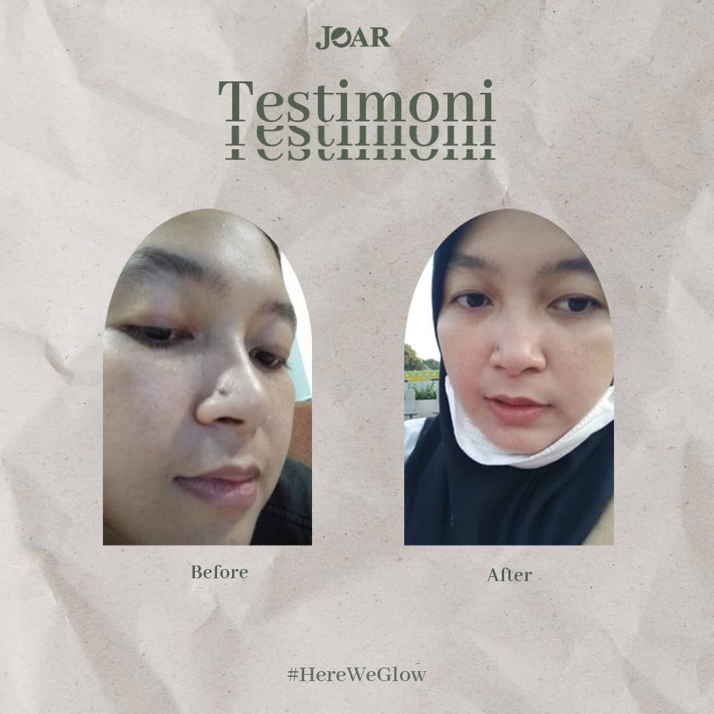 (DIJAMIN ORI 100%) - JOAR SKINCARE Paket Brightening Serum dan Facial Soap / Paket Pencerah Wajah / Sabun Muka Pria Jerawat / Sabun Wajah Glowing / Serum Essence BPOM HALAL [Bisa COD]