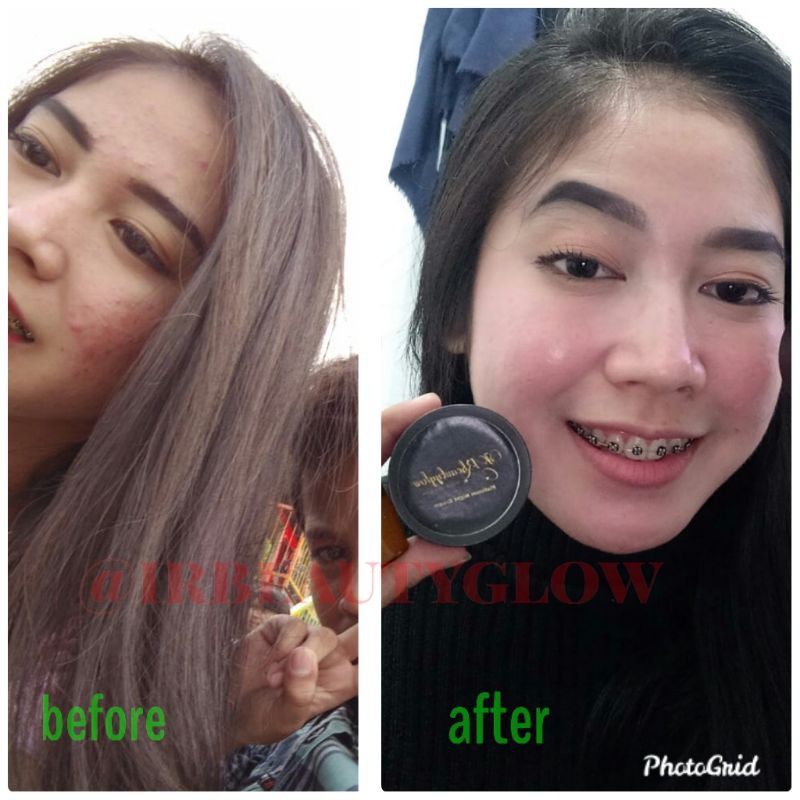 Platinum glow by Irbeautyglow cream pemutih wajah cream pemutih ampuh perawatan wajah skincare perawatan wajah perawatan kecantikan cream glowing perawatan kecantikan cream pemutih cream flek bandel pemutih wajah