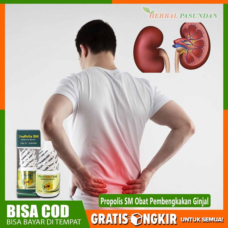 

Obat Pembengkakan Ginjal - Obat Ginjal Bengkak - Herbal Propolis Sm Brazil