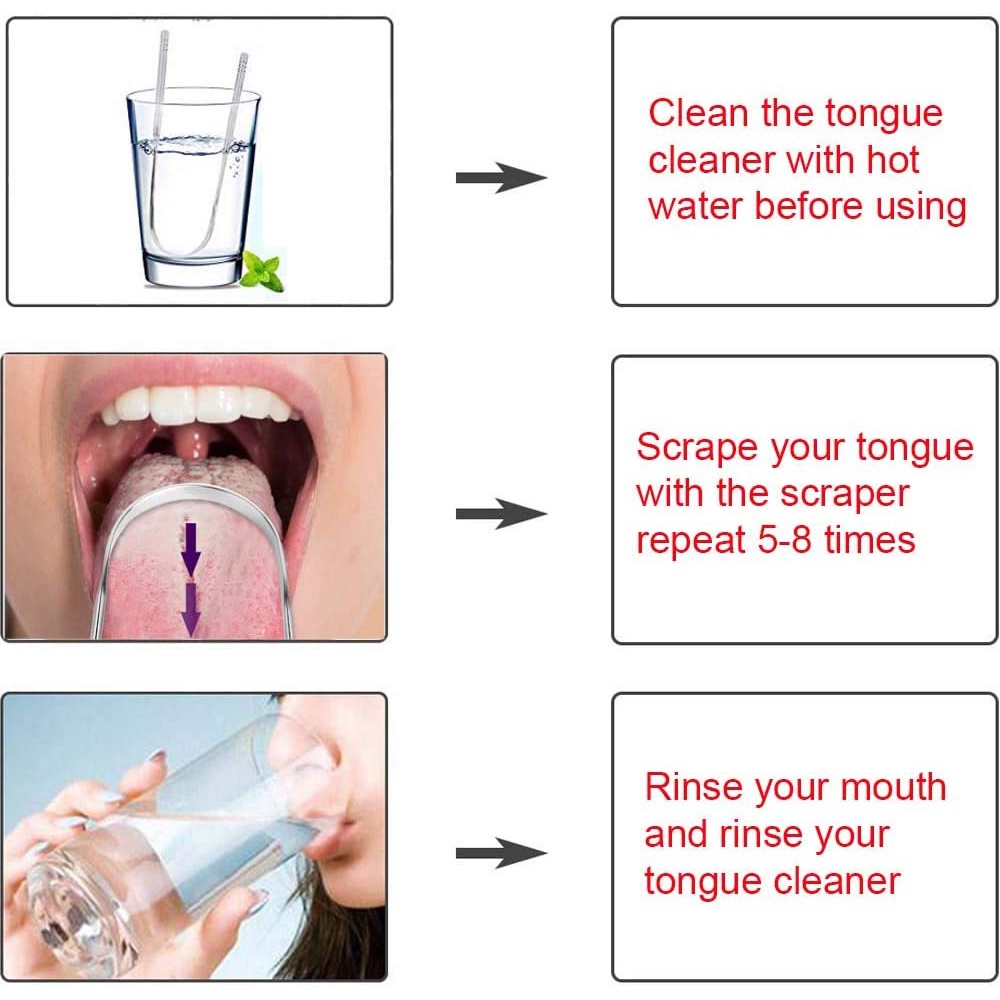 Alat Pembersih Lidah Stainless Steel - Tongue Cleaner Scraper Bau Mulut