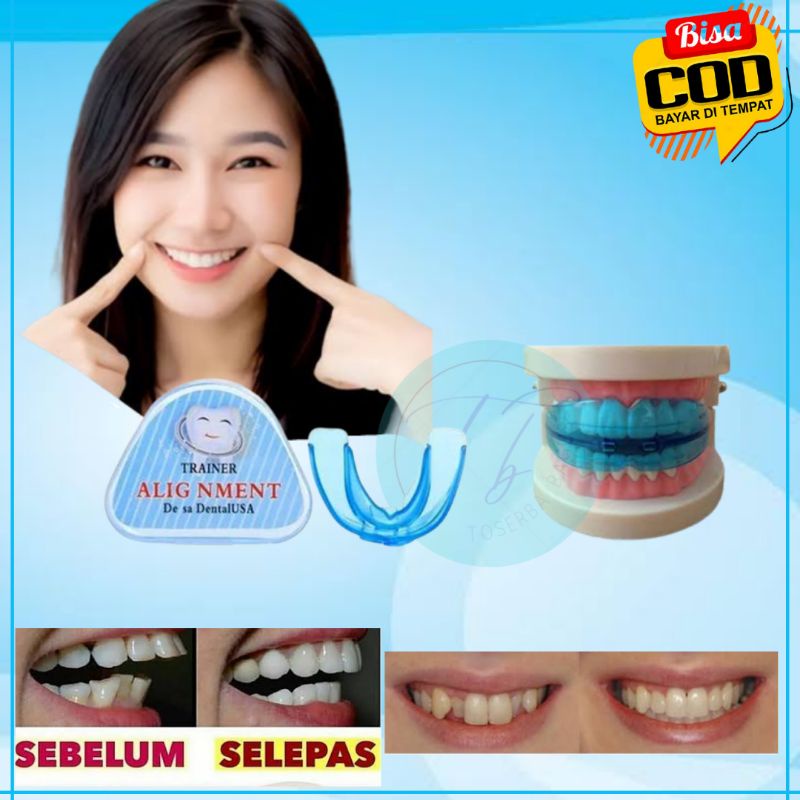 Trainer Gigi Perapi Perapih Gigi Tanpa Behel Alighnment Teeth Trainer Gigi Orthopedic Retainer Align