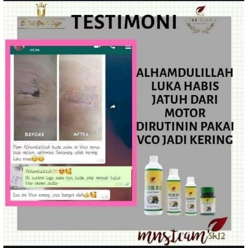 TERLARIS❤VICO oil/pengering luka/obat gatal gatal/kekebalan tubuh