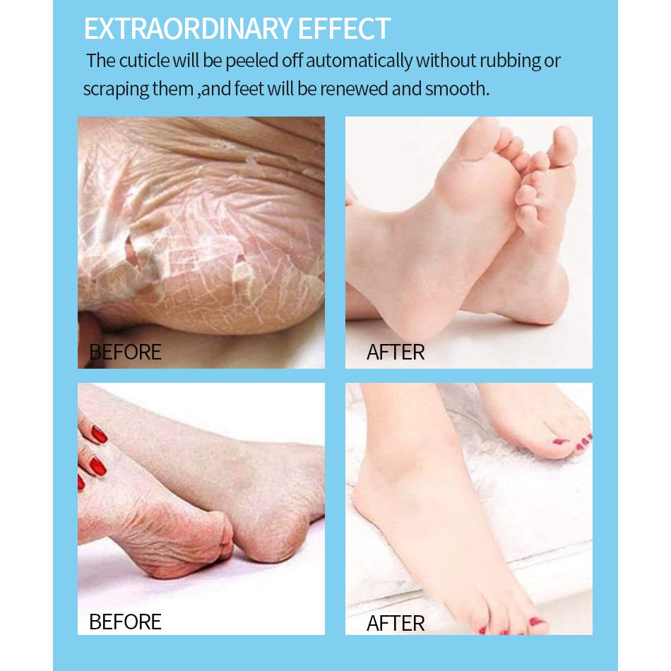 Efero Foot Mask Masker Kaki Foot Peeling Exfoliating Foot Mask