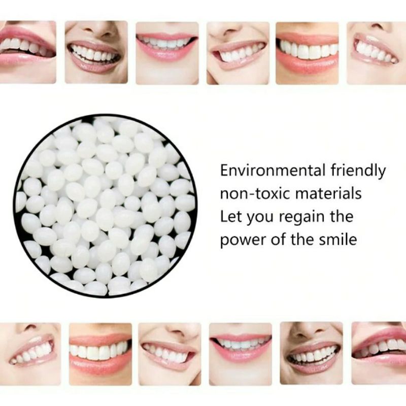 Penambal Gigi Patah Ompong Berlubang / Lem Gigi Instan 100% Ampuh/TempTooth Asli