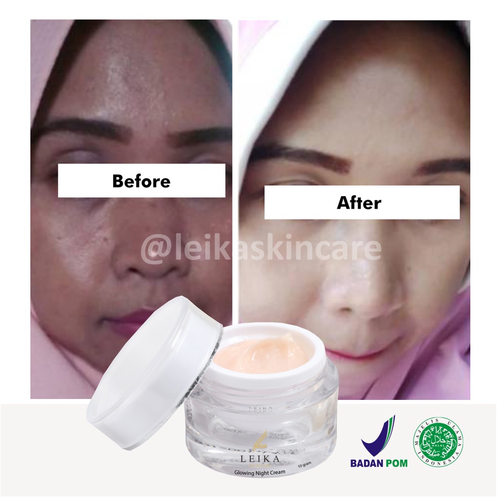 Menakjubkan! Cream Pencerah Wajah Kusam Glowing Cepat untuk Remaja BPOM Pria Wanita Asli Ampuh Krim Pemutih dan Pencerah / Perawatan wajah glowing HALAL MUI