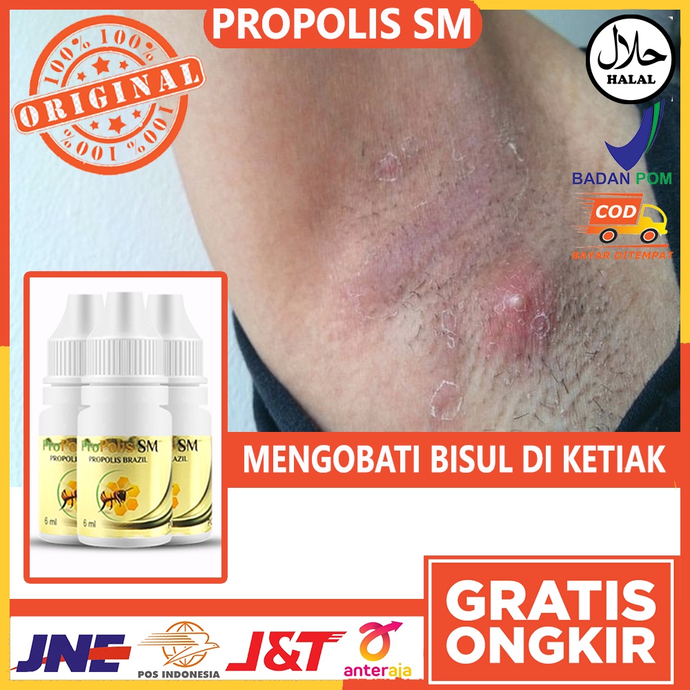 Obat Bisul Di Ketiak - Obat Bisul di Pantat - Obat Bisul di Kelamin - Obat Bisul di Kaki - Obat Bisu