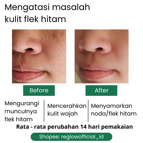 Facial Wash Reglow dr Shindy Putri Sabun Flek Hitam Perawatan Pembersih Wajah Glowing Anti Aging Rglow Skincare Penghilang Komedo Milia Untuk Kulit Kering Berminyak Sensitif Original Official Store