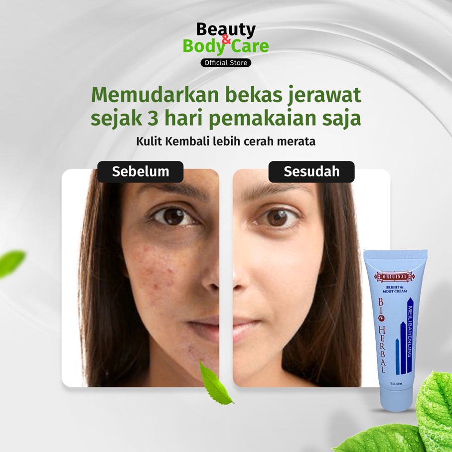 Cream Penghilang Bekas Jerawat Obat Salep Krim Penghilang Menghilangkan Bekas Jerawat Hitam Ampuh Pria Wanita Cowok Cewek