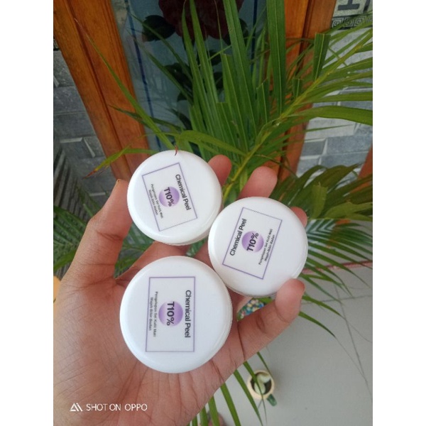 Pelling kelupas TCA 10%