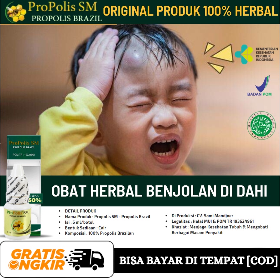 Pengecil Benjolan Di Dahi, Obat Oles Penghancur Benjolan Abnormal di Dahi, Lipoma,Herbal Propolis SM