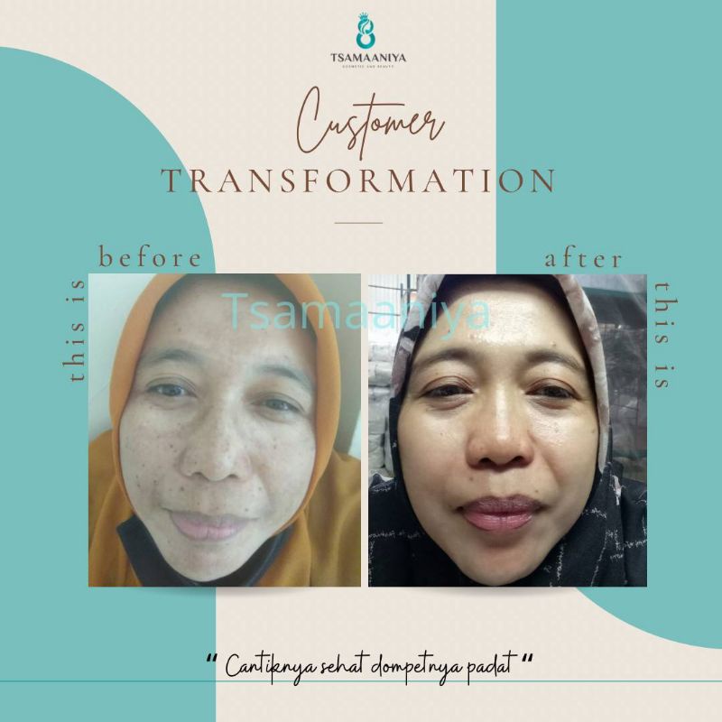 TSAMAANIYA Skincare Bpom Perawatan Wajah PAKET ALLSKIN TYPE 15gr-5