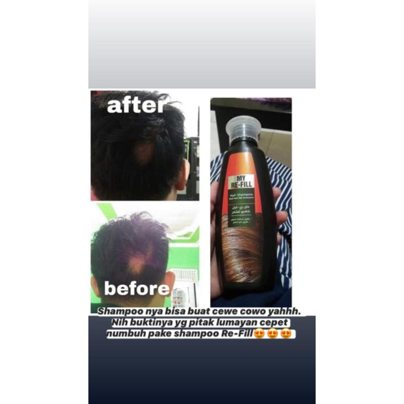 My Re-fill anti hair fall shampoo/my refill hair spray my way/shampo anti rontok My Way