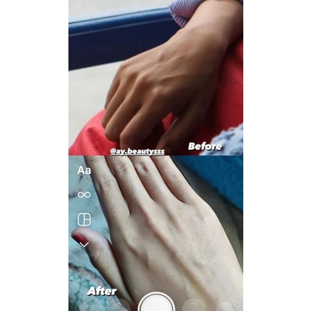 HB Dosting dan whitening @Ay.beautysss