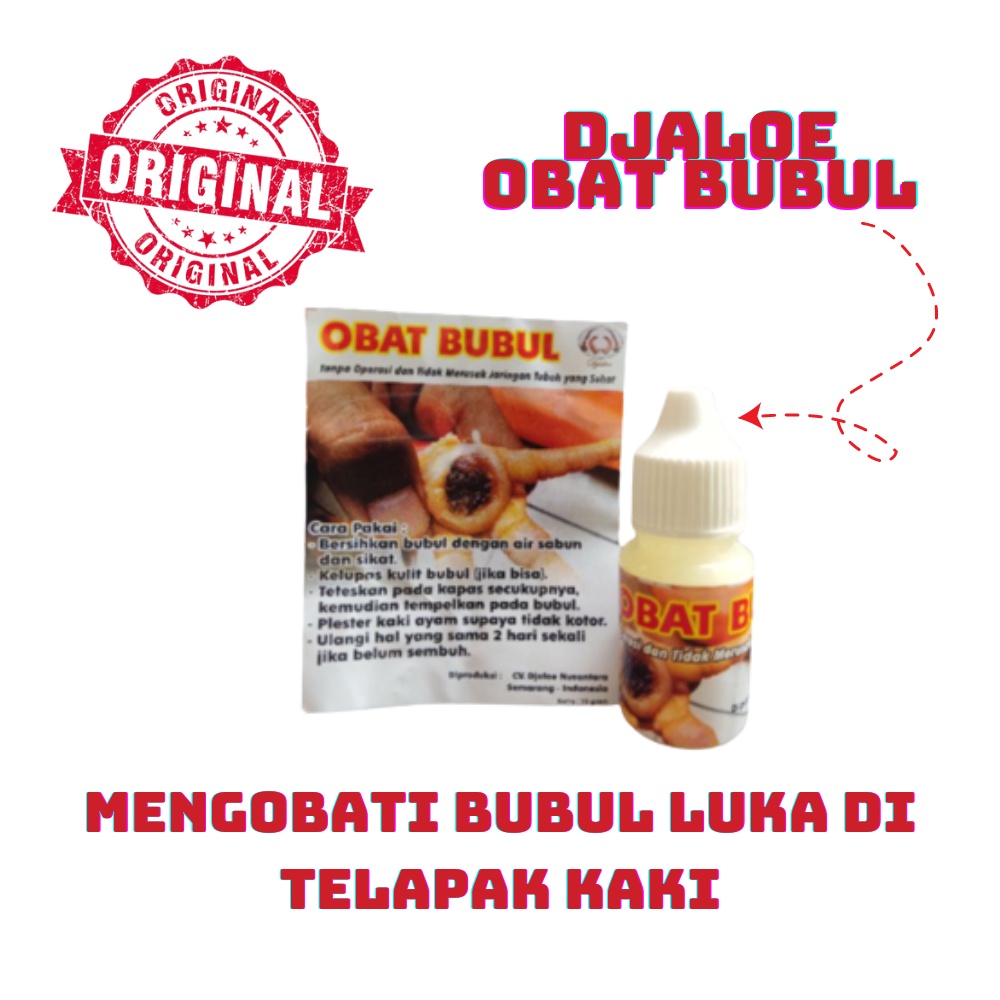 OBAT BUBUL DJALOE - mengobati bubul pada ayam