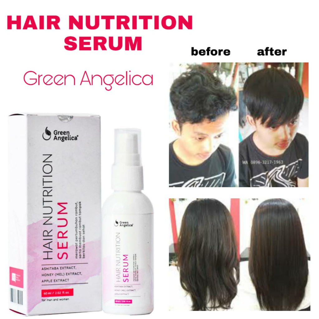 Hair Serum Pencegah Rambut Rontok Merawat Rambut Rusak Bercabang Kering Green Angelica Dalam 7 Hari Shopee Indonesia