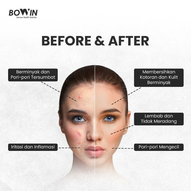 BOWIN Acne Spray ~ Obat Jerawat untuk Maskne, Back &amp; Chest Acne 75ml