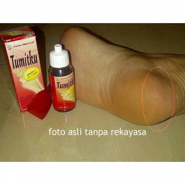 Tumitku 30ml obat kaki pecah pecah BPOM