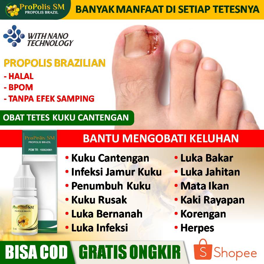 Obat Kuku Cantengan, Infeksi Jamur, Penumbuh Kuku Patah, Rusak, Luka Bernanah, Infeksi, Basah, Luka 