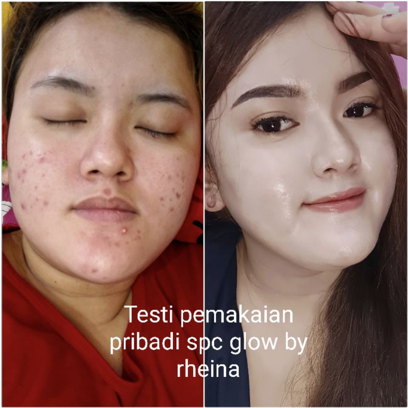 WOW! PAKET SkinCare SPC Glow || isi 4,  Untuk jerawat/bekas nya + mencerahkan