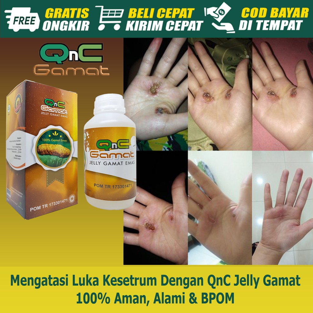 Obat Luka Kesetrum/Obat Luka Akibat Kesetrum/Obat Bekas Kesetrum/Obat Luka Bakar Kesetrum cod