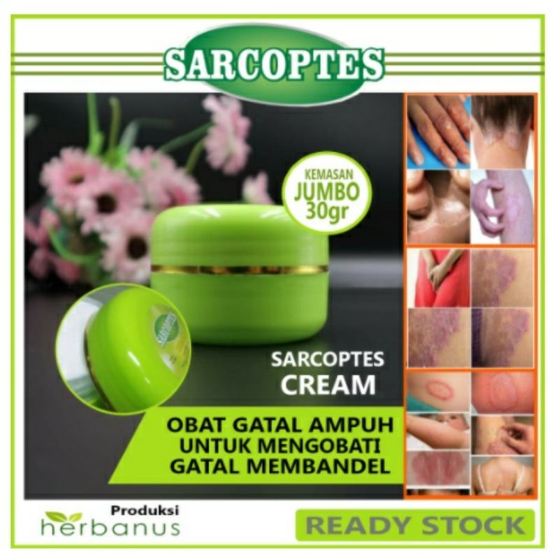 SARCOPTES SALEP OBAT GATAL EKSIM SKABIES PANU KURAP ALERGI