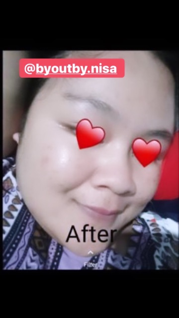 SERUM MATA ANTI KERIPUT KANTUNG MATA WHITE ANTI AGING MENGURANGI KERIPUT KERUTAN HALUS GLOWING BPOM ORI HALAL AMAN BUSUI BUMIL PROMIL BABY FACE EYE SERUM AMPUH TERBAIK SKINCARE SHOPEE AMAN KOREA FACE KOREAN INSTANT GLOWING MATA PANDA EYES ORIGINAL DOKTER